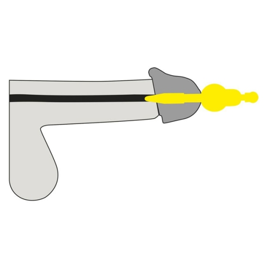 Стимулятор уретры Orion Vibrating Penis Plug